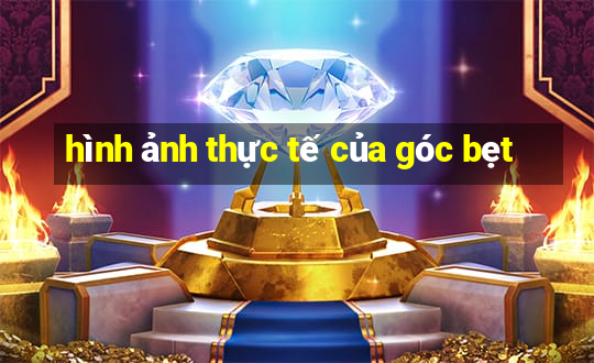 hình ảnh thực tế của góc bẹt