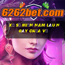 xổ số miền nam lâu ngày chưa về