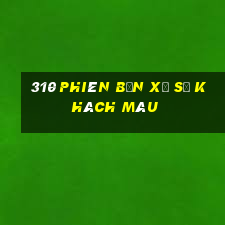 310 phiên bản xổ số khách màu