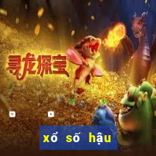 xổ số hậu giang xổ số hậu giang