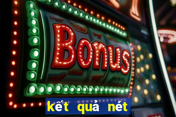 kết quả nét việt 30 ngày