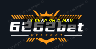 đứt chân chảy máu