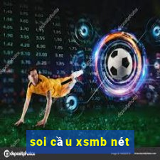 soi cầu xsmb nét