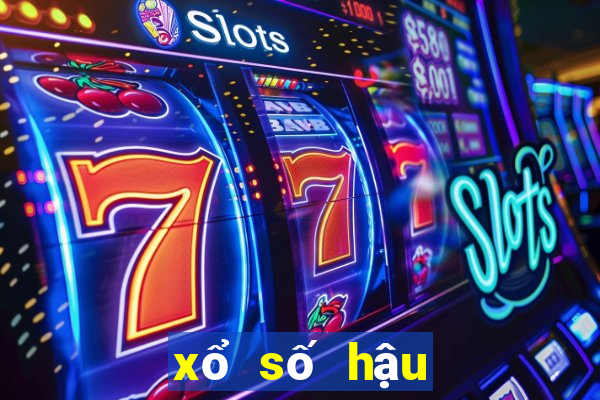 xổ số hậu giang 30 ngày qua