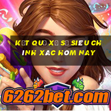 kết quả xổ số siêu chính xác hôm nay