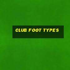 club foot types