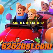 soi kèo tài xỉu