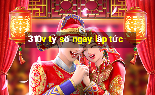 310v tỷ số ngay lập tức